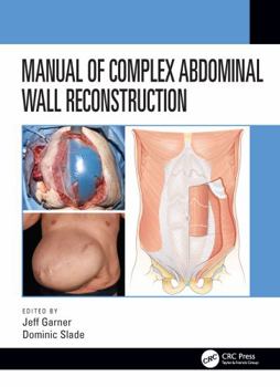 Hardcover Manual of Complex Abdominal Wall Reconstruction Book