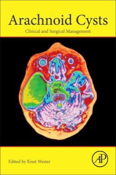 Paperback Arachnoid Cysts: Clinical and Surgical Management Book