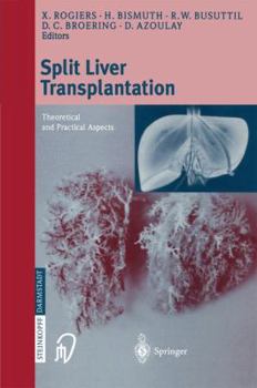 Paperback Split Liver Transplantation: Theoretical and Practical Aspects Book