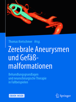 Hardcover Zerebrale Aneurysmen Und Gefäßmalformationen: Behandlungsgrundlagen Und Neurochirurgische Therapie in Fallbeispielen [German] Book