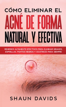 Paperback C?mo Eliminar el Acn? de Forma Natural y Efectiva: Remedios altamente efectivos para eliminar granos, espinillas, puntos negros y cicatrices para siem [Spanish] Book