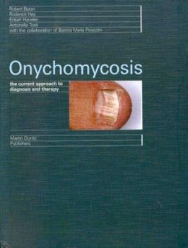 Hardcover Onychomycosis: The Current Approach to Diagnosis and Therapy Book