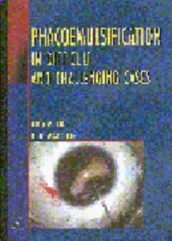 Hardcover Phacoemulsification in Difficult and Challenging Cases Book