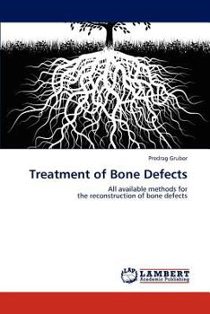 Paperback Treatment of Bone Defects Book