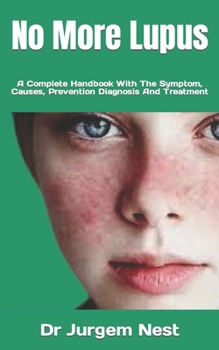 Paperback No More Lupus: A Complete Handbook With The Symptom, Causes, Prevention Diagnosis And Treatment Book