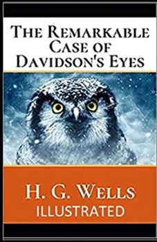 The Remarkable Case of Davidson's Eyes Illustrated