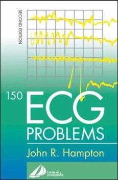 Paperback 150 ECG Problems Book