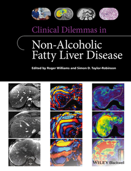 Paperback Clinical Dilemmas in Non-Alcoholic Fatty Liver Disease Book