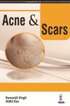 Paperback ACNE and SCARS Book