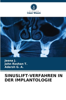 Paperback Sinuslift-Verfahren in Der Implantologie [German] Book