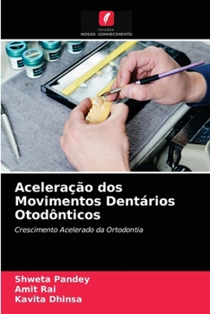 Paperback Aceleração dos Movimentos Dentários Otodônticos [Portuguese] Book