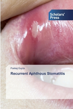 Paperback Recurrent Aphthous Stomatitis Book