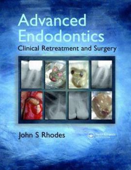 Hardcover Advanced Endodontics: Clinical Retreatment and Surgery Book