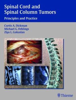 Hardcover Spinal Cord and Spinal Column Tumors: Principles and Practice Book