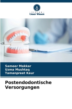 Paperback Postendodontische Versorgungen [German] Book