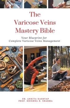 Paperback The Varicose Veins Mastery Bible: Your Blueprint for Complete Varicose Veins Management Book