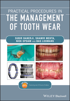 Paperback Practical Procedures in the Management of Tooth Wear Book