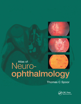 Paperback Atlas of Neuro-ophthalmology Book