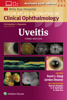 Paperback Uveitis Book