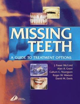 Paperback Missing Teeth: A Guide to Treatment Options Book