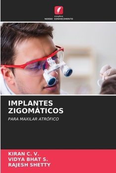 Paperback Implantes Zigomáticos [Portuguese] Book