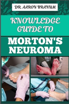 KNOWLEDGE GUIDE TO MORTON’S NEUROMA: Essential Manual To Symptoms, Diagnosis, Treatment, And Pain Relief For Foot Health And Nerve Pain Management