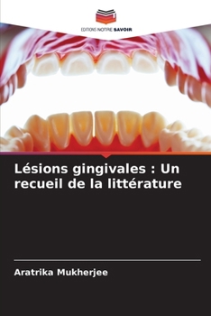 Paperback Lésions gingivales: Un recueil de la littérature [French] Book