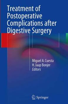 Paperback Treatment of Postoperative Complications After Digestive Surgery Book