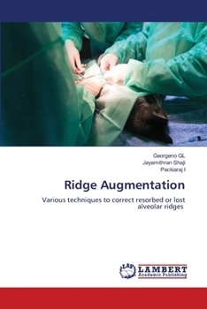 Paperback Ridge Augmentation Book