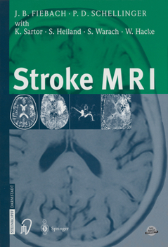 Paperback Stroke MRI Book