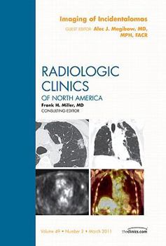 Imaging of Incidentalomas, an Issue of Radiologic Clinics of North America, 49
