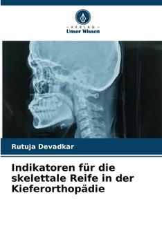 Paperback Indikatoren für die skelettale Reife in der Kieferorthopädie [German] Book