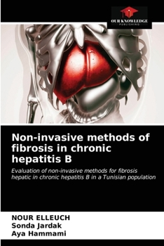 Paperback Non-invasive methods of fibrosis in chronic hepatitis B Book