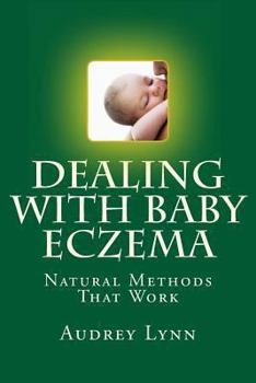 Paperback Dealing With Baby Eczema: Natural Methods That Work Book