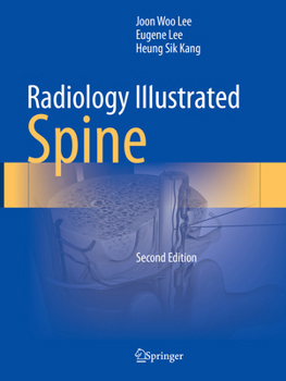 Paperback Radiology Illustrated: Spine Book
