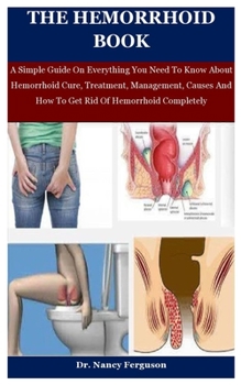 Paperback The Hemorrhoid Book: A Simple Guide On Everything You Need To Know About Hemorrhoid Cure, Treatment, Management, Causes And How To Get Rid Book