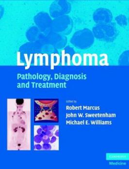 Hardcover Lymphoma: Pathology, Diagnosis and Treatment Book