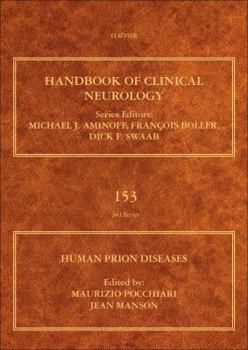 Hardcover Human Prion Diseases: Volume 153 Book