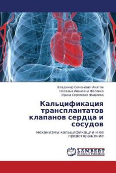 Paperback Kal'tsifikatsiya Transplantatov Klapanov Serdtsa I Sosudov [Russian] Book
