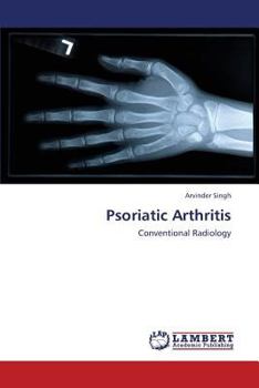 Paperback Psoriatic Arthritis Book