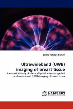 Paperback Ultrawideband (Uwb) Imaging of Breast Tissue Book