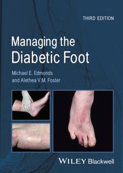 Paperback Managing the Diabetic Foot Book