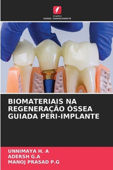 Biomateriais Na Regeneração Óssea Guiada Peri-Implante (Portuguese Edition)