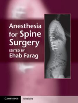 Hardcover Anesthesia for Spine Surgery Book