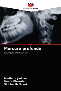 Paperback Morsure profonde [French] Book