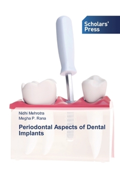 Paperback Periodontal Aspects of Dental Implants Book