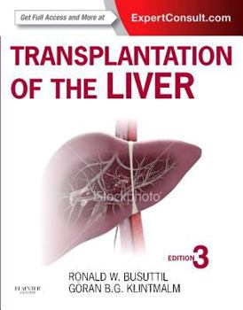 Hardcover Transplantation of the Liver Book