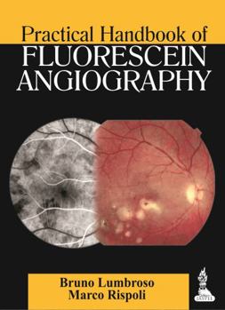 Paperback Practical Handbook of Fluorescein Angiography Book