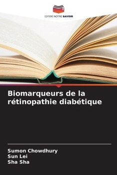 Paperback Biomarqueurs de la rétinopathie diabétique [French] Book