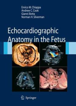 Hardcover Echocardiographic Anatomy in the Fetus [With DVD] Book